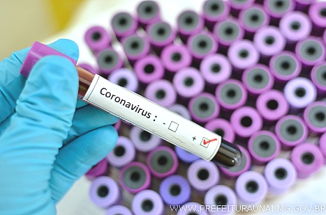 Coronavírus Unaí: que fazer em caso de sintomas?