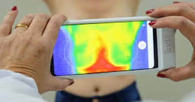 Programa Linda Lifetech oferece mil exames da mama para mulheres a partir de 20 anos 