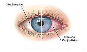 conjunti 0001